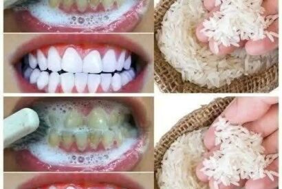 Thumbnail for Teeth Whitening in Just 1 Minute Using Baking Soda, Lemon Juice, and…. !!