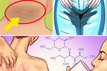 Thumbnail for 8 Silent Signals Your Body Is Getting Too Much Sugar