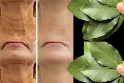Thumbnail for Bay Leaf Is 100,000 Times Stronger Than Botox? | Natural Wrinkle Eraser Even at Age 70!