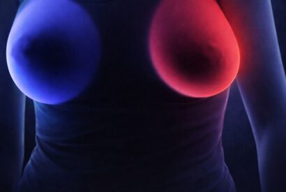 Thumbnail for Breast cancer: 4 early signs every woman should know.