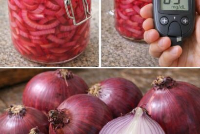 Thumbnail for Have You Tried This Simple Red Onion Pickle for Everyday Wellness?