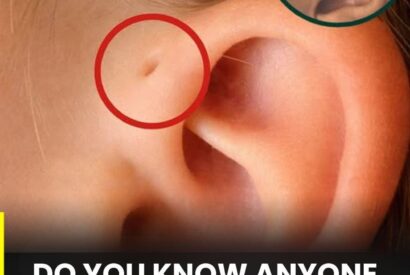 Thumbnail for Discover the meaning of this particular mark on the ear.