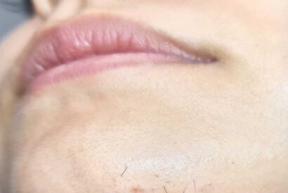 Thumbnail for Chin Hair in Women: Hidden Health Signs, Hormone Imbalance & What It Means for Your Body