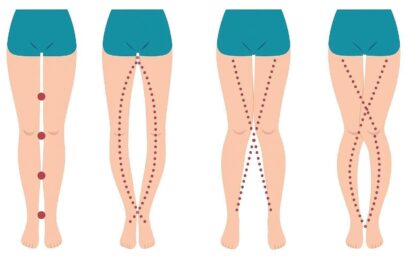 Thumbnail for What Your Legs Can’t Say, Your Vagina Can — The Truth About the Female Body Most People Don’t Know