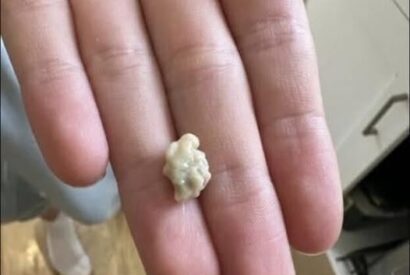 Thumbnail for I sneezed 4-5 times yesterday and then felt something tickling my throat. Today, my throat is completely clear after this little thing came out. What is this? Well, you’d better know