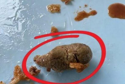 Thumbnail for Found this in my fried chicken. It was in the breαst.