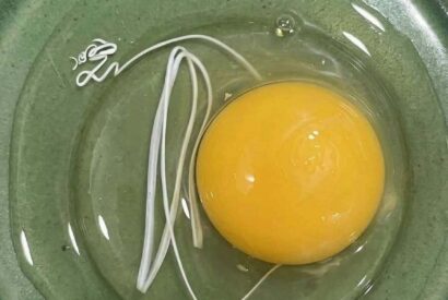Thumbnail for I Thought the White String in My Egg Was Something Dangerous—The Truth Completely Surprised Me